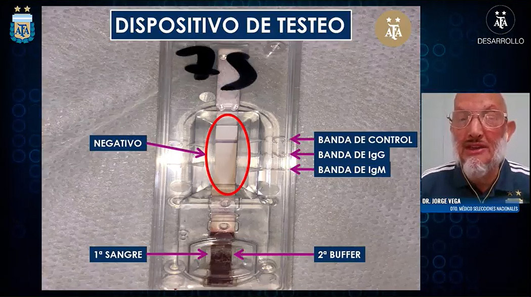 Charla informativa sobre la realización de los testeos serológicos rápidos para la detección de COVID-19